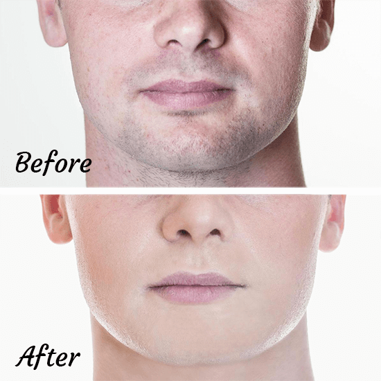 before and after beard shadow makeup