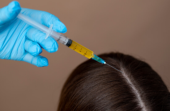 applying PRP in scalp